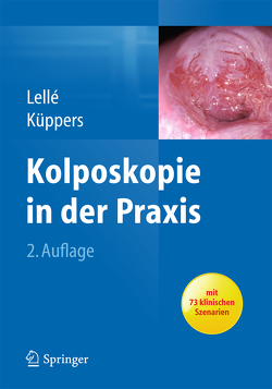 Kolposkopie in der Praxis von Küppers,  Volkmar, Lellé,  Ralph J.