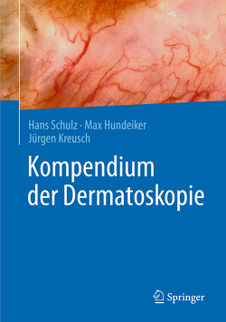 Kompendium der Dermatoskopie von Hundeiker,  Max, Kreusch,  Jürgen, Schulz,  Hans