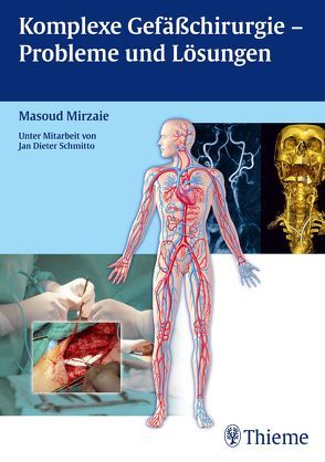 Komplexe Gefäßchirurgie – Probleme und Lösungen von Mirzaie,  Masoud