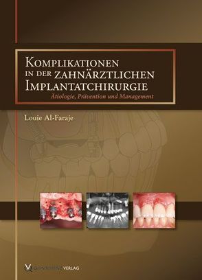 Komplikationen in der zahnärztlichen Implantatchirurgie von Al-Faraje,  Louie