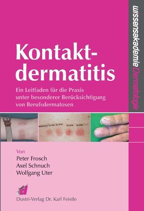 Kontaktdermatitis von Frosch,  Peter, Schnuch,  Axel, Uter,  Wolfgang