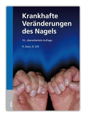 Krankhafte Veränderungen des Nagels von Dill,  Dorothee, Zaun,  Hansotto