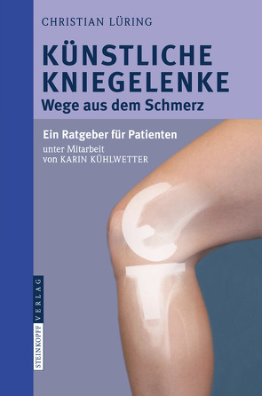 Künstliche Kniegelenke von Kühlwetter,  Karin, Lüring,  C.