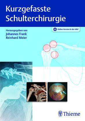 Kurzgefasste Schulterchirurgie von Frank,  Johannes, Meier,  Reinhard