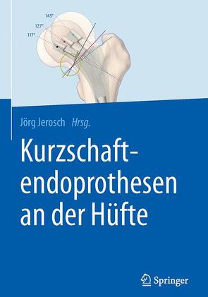 Kurzschaftendoprothesen an der Hüfte von Jerosch,  Jörg