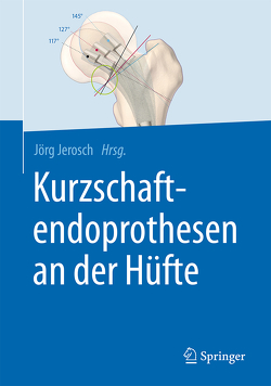 Kurzschaftendoprothesen an der Hüfte von Jerosch,  Jörg