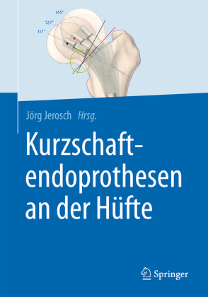 Kurzschaftendoprothesen an der Hüfte von Jerosch,  Jörg