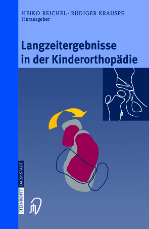 Langzeitergebnisse in der Kinderorthopädie von Krauspe,  Rüdiger, Reichel,  Heiko