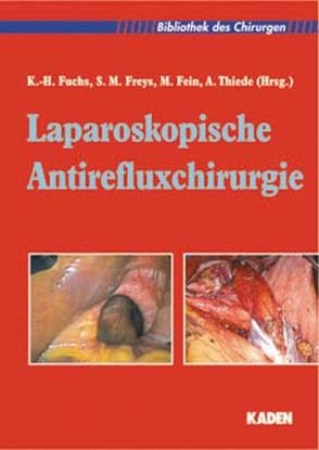 Laparoskopische Antirefluxchirurgie von Fein,  Martin, Freys,  Stephan M, Fuchs,  Karl H