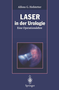 Laser in der Urologie von Baumgartner,  R., Berlien,  H.-P., Ehsan,  A., Frank,  F., Friesen,  A., Fuchs,  B., Gorisch,  W., Hofstetter,  Alfons G., Klammert,  R., Kriegmair,  M., Lubos,  W., Müller,  G., Mutschter,  R., Rothenberger,  K.-H., Schmeller,  N., Schneede,  P., Waidelich,  W., Wondrazek,  F.