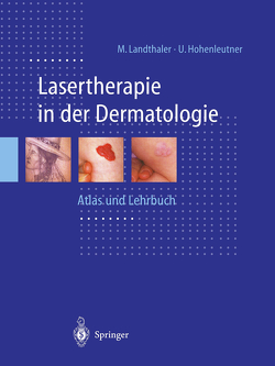 Lasertherapie in der Dermatologie von Braun-Falco,  O., Hohenleutner,  Ulrich, Landthaler,  Michael