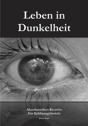 Leben in Dunkelheit – Akanthamöben-Keratitis von Kogel,  Jessica