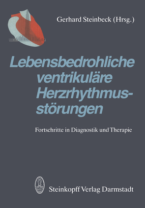 Lebensbedrohliche ventrikuläre Herzrhythmusstörungen von Steinbeck,  G.