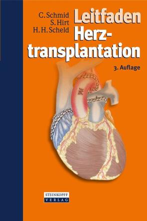 Leitfaden Herztransplantation von Hirt,  Stephan, Scheld,  Hans Heinrich, Schmid,  Christof