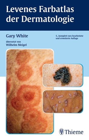 Levenes Farbatlas der Dermatologie von Gary White,  Wilhelm Meigel