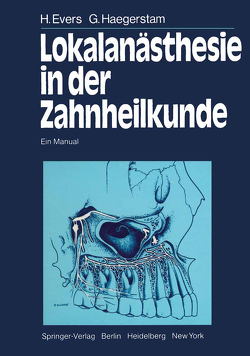 Lokalanästhesie in der Zahnheilkunde von Björk,  L., Buckhöj,  P., Evers,  H., Haegerstam,  G., Hakansson,  L., Singer,  R., Wilstermann,  G.