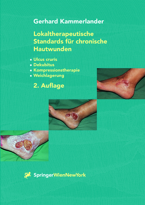 Lokaltherapeutische Standards für chronische Hautwunden von Kammerlander,  Gerhard