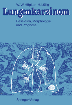 Lungenkarzinom von Doerr,  W., Höpker,  Wilhelm-Wolfgang, Linder,  F., Lüllig,  Helmut