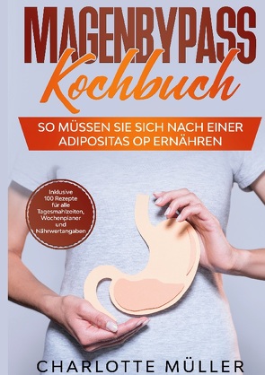 Magenbypass Kochbuch von Müller,  Charlotte