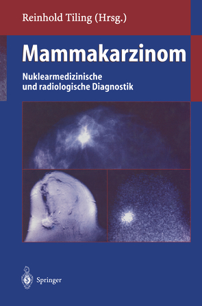 Mammakarzinom von Hahn,  K., Lissner,  J., Tiling,  Reinhold