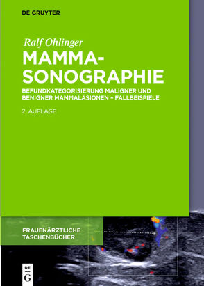 Mammasonographie von Ohlinger,  Ralf