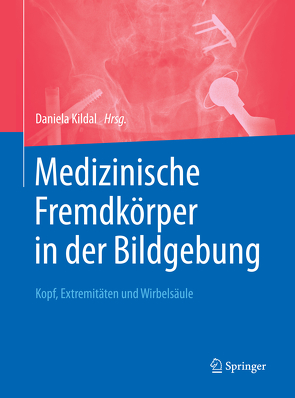 Medizinische Fremdkörper in der Bildgebung von Kildal,  Daniela