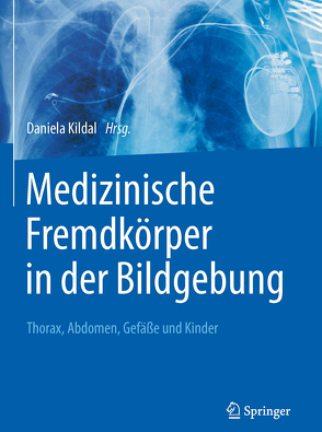 Medizinische Fremdkörper in der Bildgebung von Kildal,  Daniela