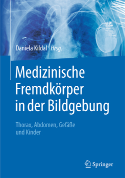 Medizinische Fremdkörper in der Bildgebung von Kildal,  Daniela