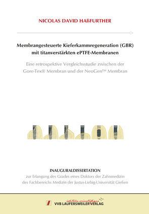 Membrangesteuerte Kieferkammregeneration (GBR) mit titanverstärkten ePTFE-Membranen von Haßfurther,  Nicolas David