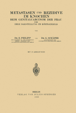 Metastasen und Rezidive im Knochen von Philipp,  E., Schäfer,  G.