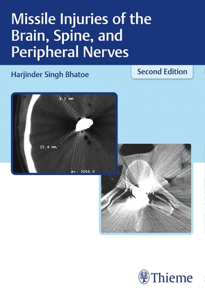 Missile Injuries of the Brain, Spine, and Peripheral Nerves von Bhatoe,  Harjinder S.