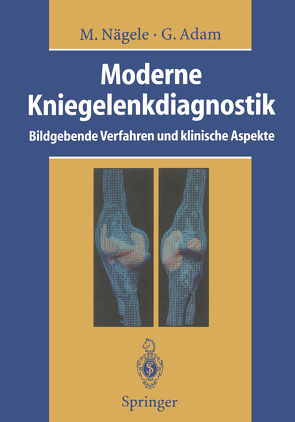 Moderne Kniegelenkdiagnostik von Adam,  Gerhard, Bloem,  J.L., Günther,  R.W., Hansis,  M., Helbich,  T., Hotzeerger,  L.A., Kainberger,  F.M., Kramer,  J, Lehner,  K., Mohr,  E, Nägele,  M., Nägele,  Matthias, Otto,  H., Overbeck,  B., Rüther,  W., Scheurecker,  A., Schneider,  T., Steuer,  K., Vahlensieck,  M., Woude,  H.J. van der, Wülker,  N.