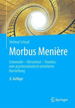 Morbus Menière von Schaaf,  Helmut