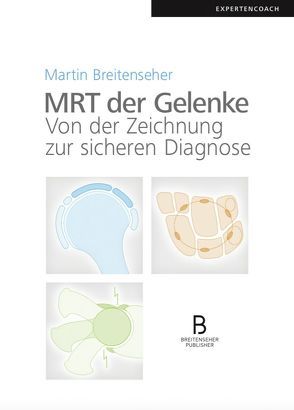 MRT der Gelenke von Breitenseher,  Martin