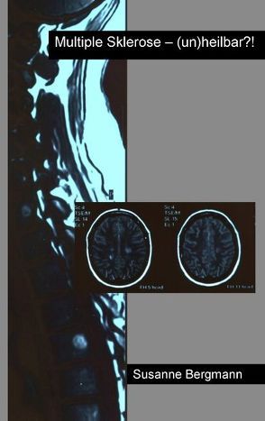 Multiple Sklerose – (un)heilbar?! von Bergmann,  Susanne