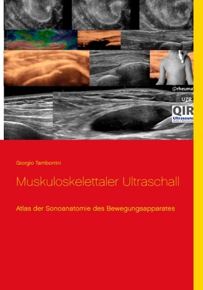 Muskuloskelettaler Ultraschall von Tamborrini,  Giorgio