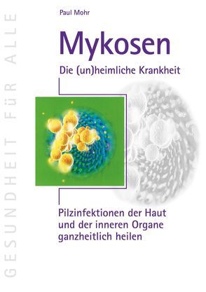 Mykosen – Die (un)heimliche Krankheit von Mohr,  Paul