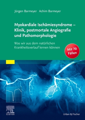 Myokardiale Ischämiesyndrome – Klinik, postmortale Angiografie und Pathomorphologie von Barmeyer,  Achim, Barmeyer,  Jürgen