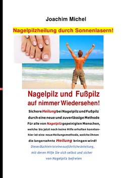 Nagelpilzheilung durch Sonnenlasern! Nagelpilz und Fußpilz auf nimmer Wiedersehen! von Michel,  Joachim