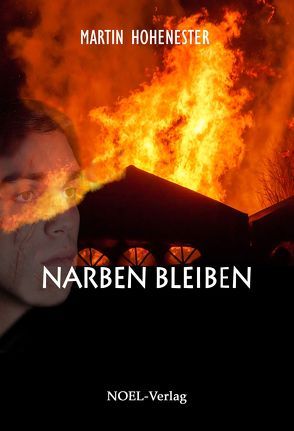 Narben bleiben von Hohenester,  Martin