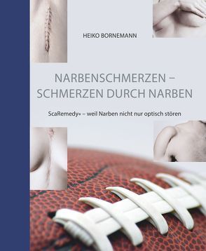 Narbenschmerzen – Schmerzen durch Narben von Bornemann,  Heiko