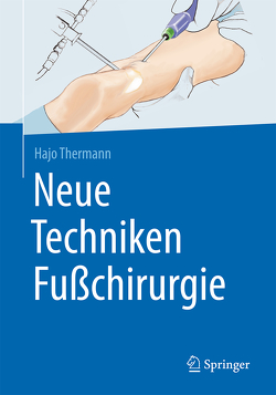 Neue Techniken Fußchirurgie von Thermann,  Hajo