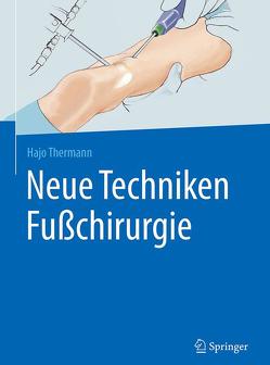 Neue Techniken Fußchirurgie von Thermann,  Hajo