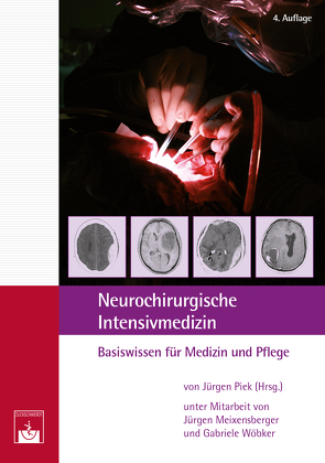 Neurochirurgische Intensivmedizin von Meixensberger,  Jürgen, Piek,  Jürgen, Wöbker,  Gabriele﻿