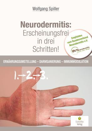 Neurodermitis: Erscheinungsfrei in drei Schritten! von Wolfgang,  Spiller