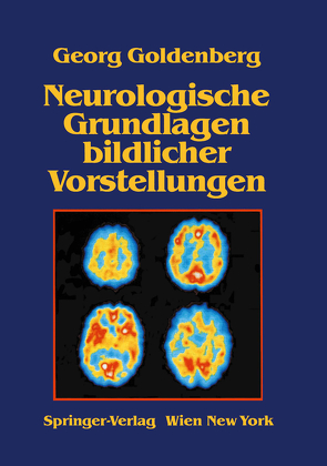 Neurologische Grundlagen bildlicher Vorstellungen von Goldenberg,  G.