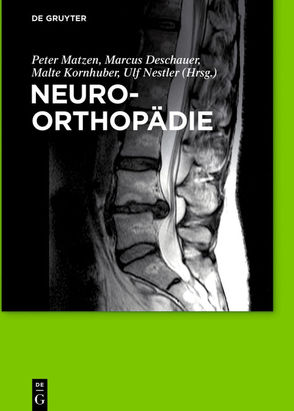 Neuroorthopädie von Baum,  Petra, Bertsche,  Astrid, Deppe,  Wolfgang, Deschauer,  Marcus, Hanisch,  Frank, Hoffmann,  Karl-Titus, Kornhuber,  Malte, Kraya,  Torsten, Lay,  Martin, Matzen,  Peter, Merkenschlager,  Andreas, Nestler,  Ulf, Preuss,  Matthias