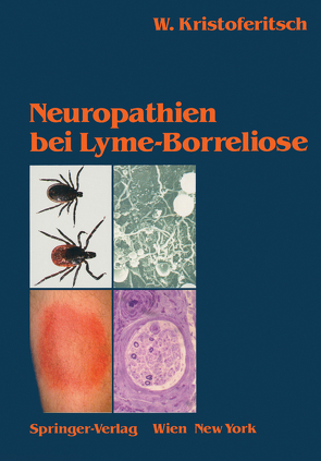 Neuropathien bei Lyme-Borreliose von Burgdorfer,  W., Kristoferitsch,  Wolfgang