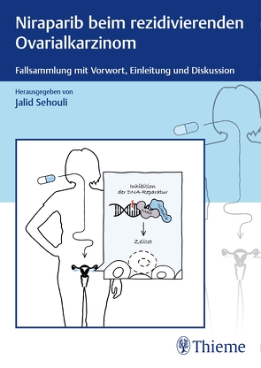 Niraparib beim rezidivierenden Ovarialkarzinom