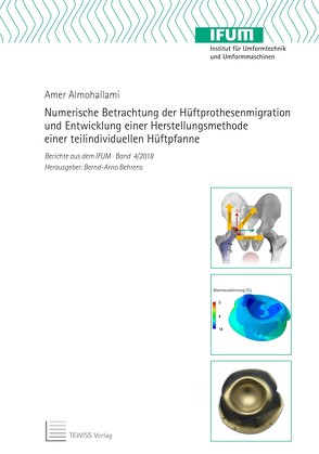 Numerische Betrachtung der Hüftprothesenmigration und Entwicklung einer Herstellungsmethode einer teilindividuellen Hüftpfanne von Almohallami,  Amer, Behrens,  Bernd-Arno